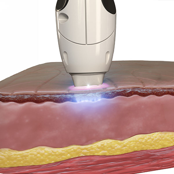 Divine Pro TriFractional